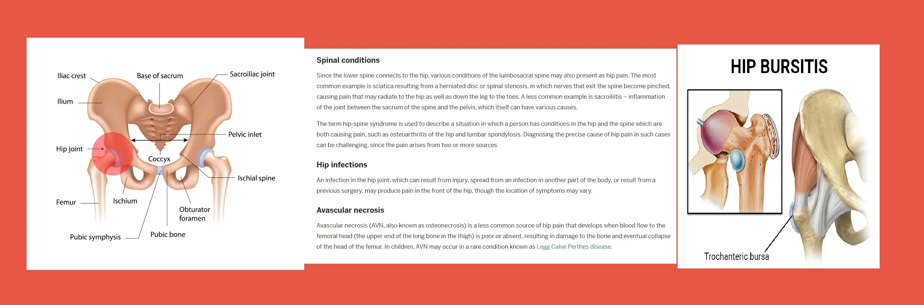 HIP JOINT PAIN FORMULA - hip dysplasia , arthritis or other osteoarthritis
