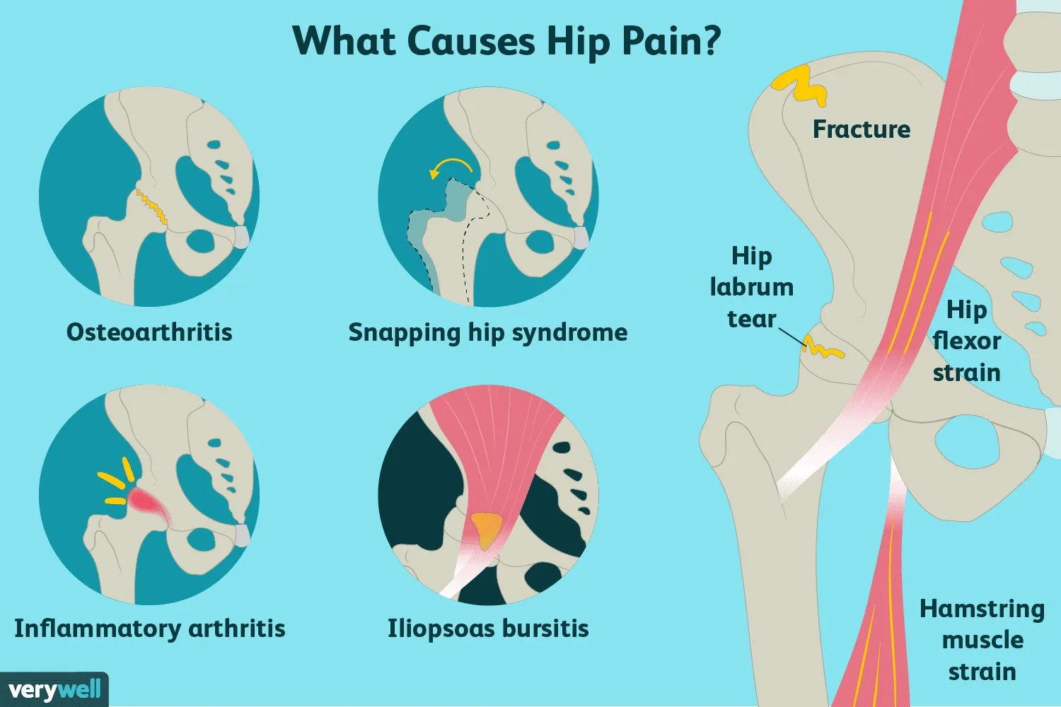 HIP JOINT PAIN FORMULA - hip dysplasia , arthritis or other osteoarthritis