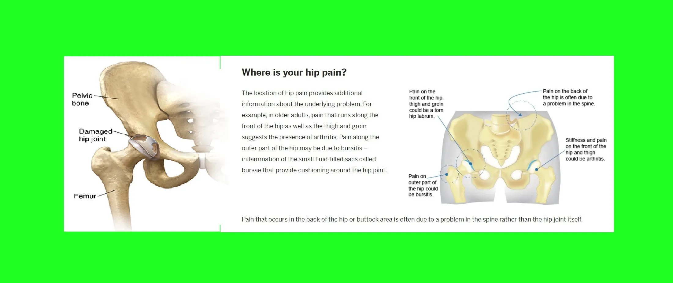 HIP JOINT PAIN FORMULA - hip dysplasia , arthritis or other osteoarthritis